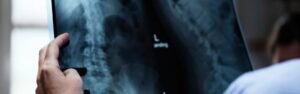 Your First visit to see a chiropractor in pompano beach Florida